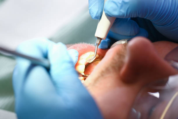Best Tooth Pain Emergency Relief  in Leavittsburg, OH