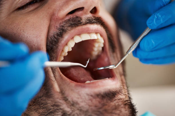 Best Chipped Tooth Repair Near Me  in Leavittsburg, OH